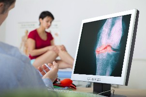 artróza diagnostika
