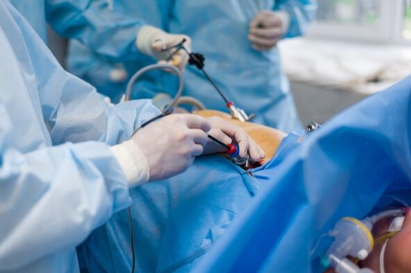 V pokročilé fázi osteochondrózy bederní páteře je nutná operace