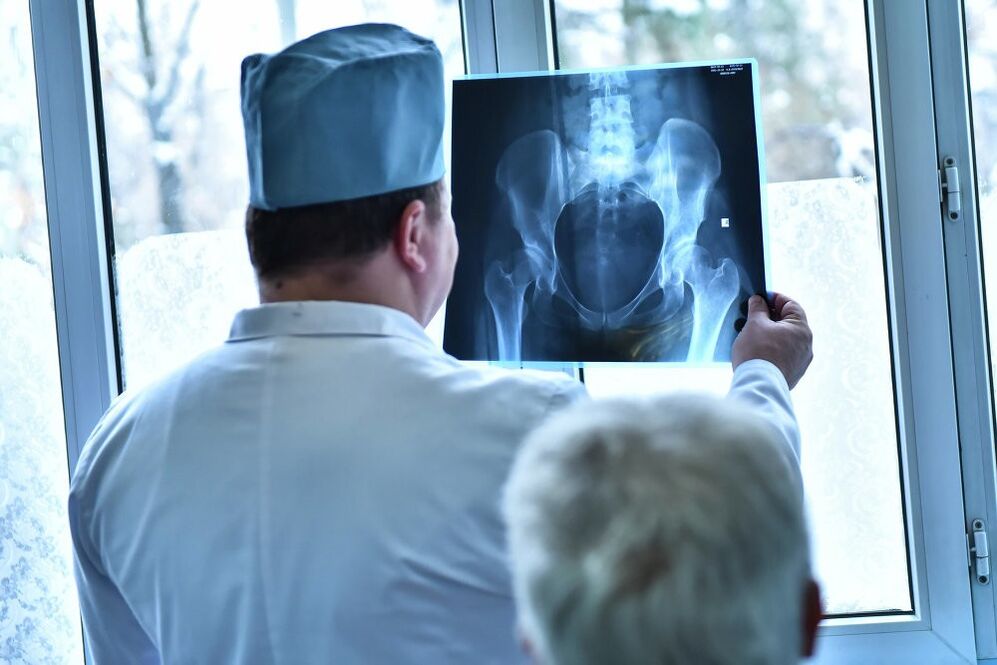 Lékař se dívá na obrázek kyčelního kloubu s artrózou