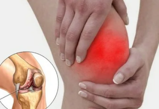 Co se děje artritidy